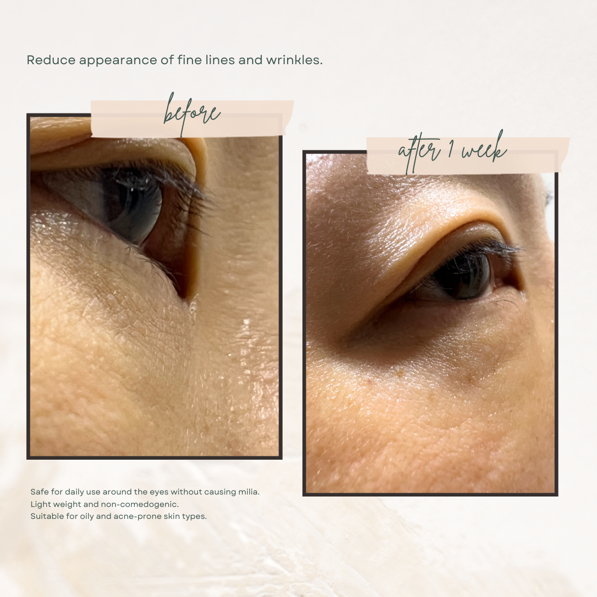 Bulgarian Rose Treatment Oil 10ml