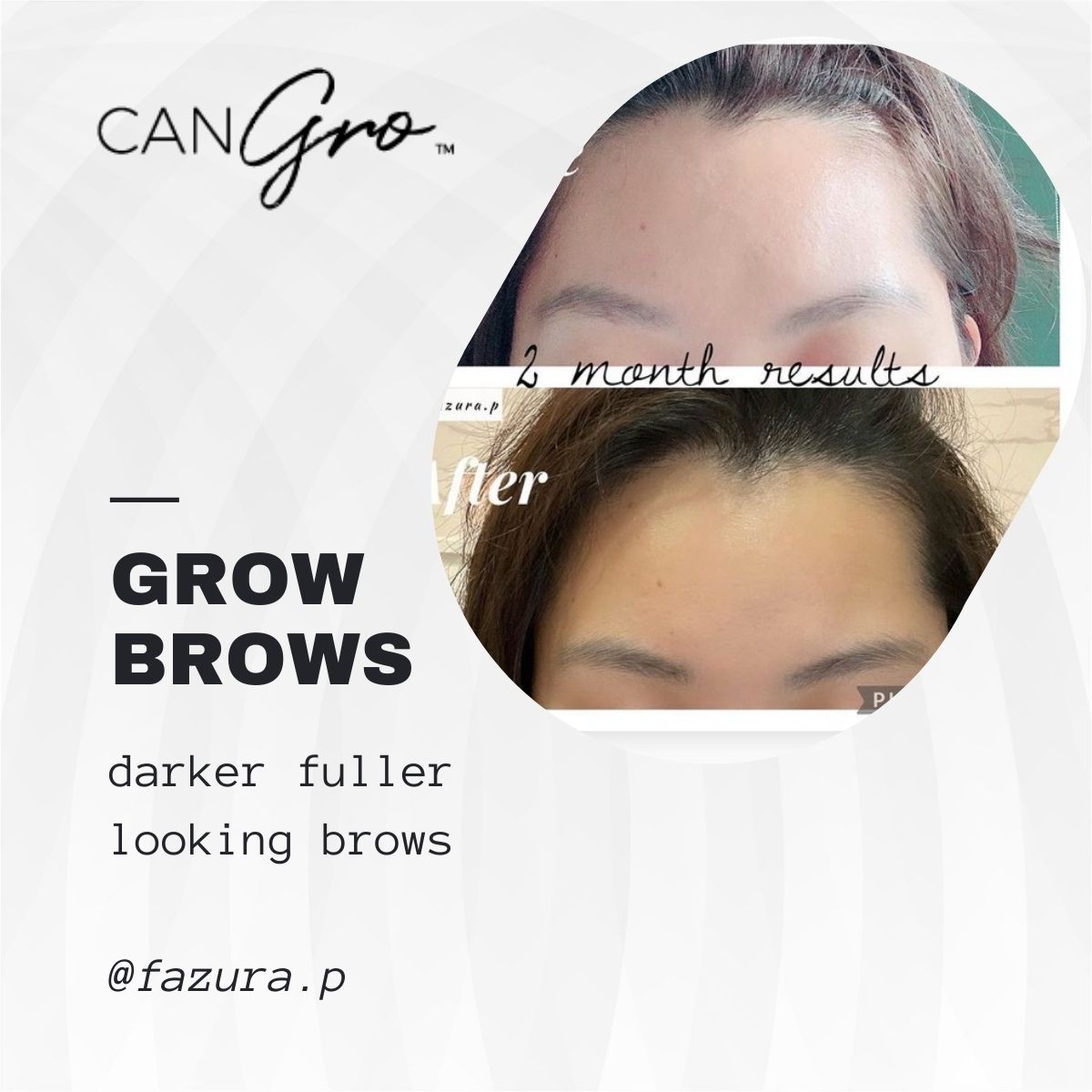 Bold Brows Eyebrow Enhancer (eyebrow growth serum)