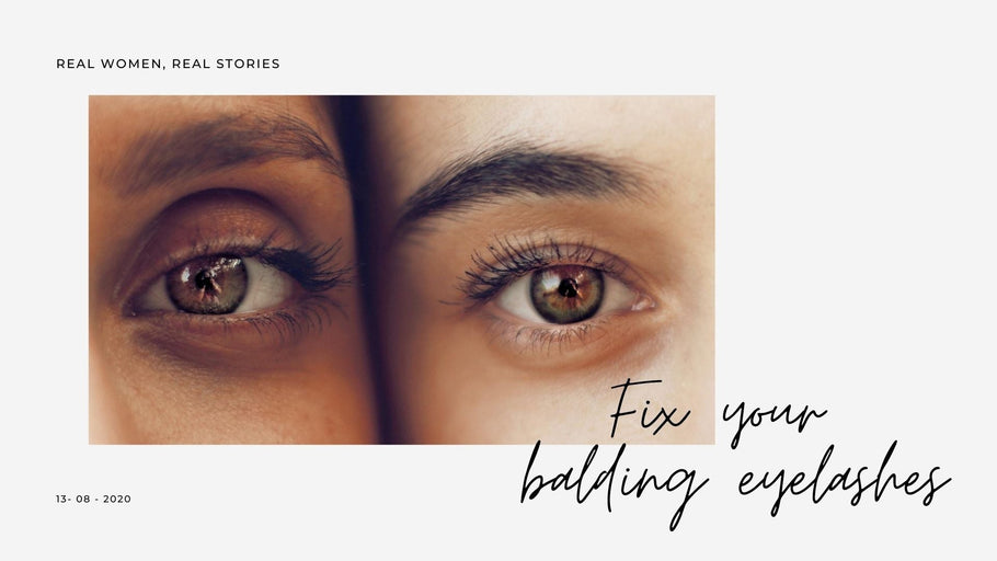 The long and short of how I fixed my balding eyelashes