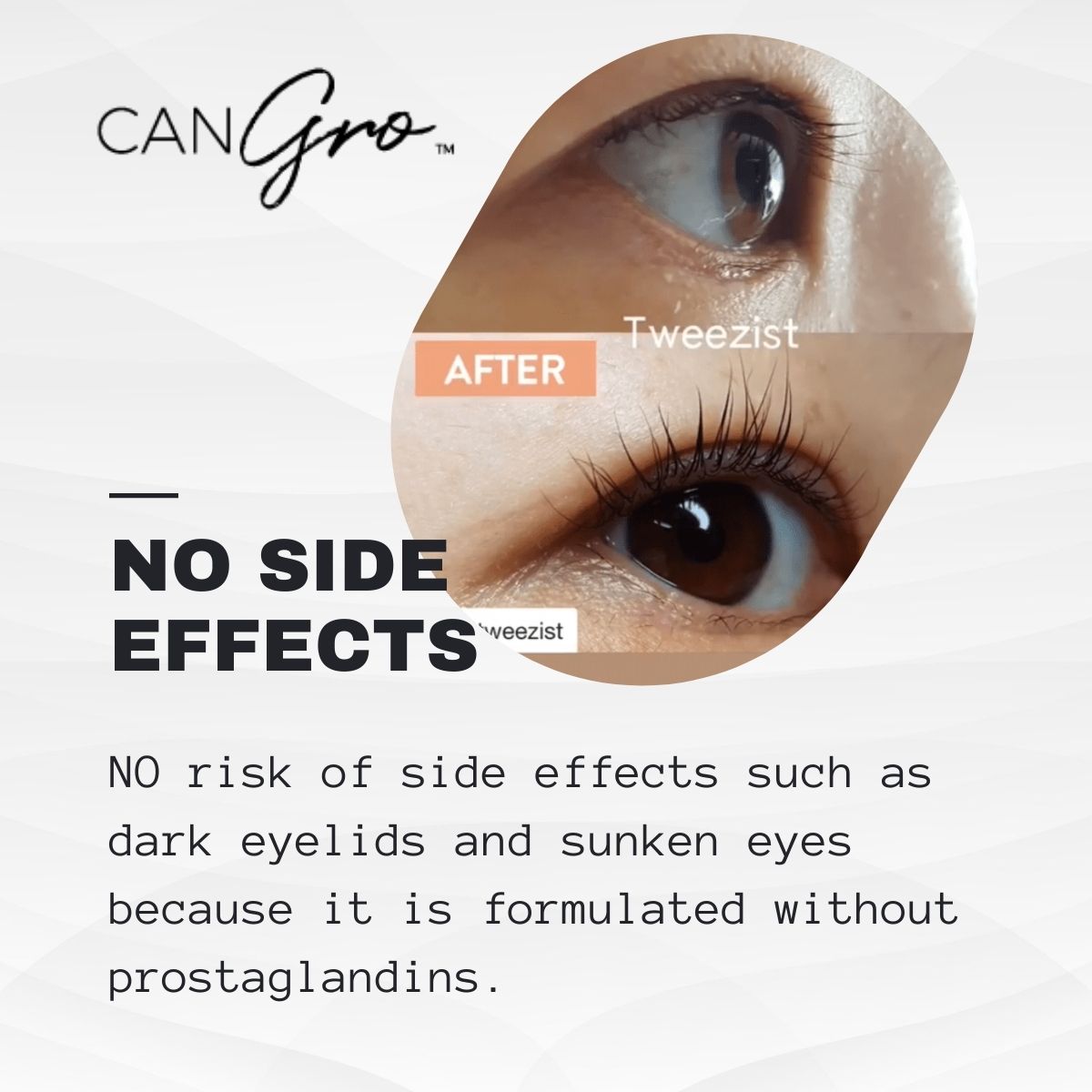 🇦🇺 Long Lashes Eyelash Enhancer  (Buy 1 Get 1 Free)