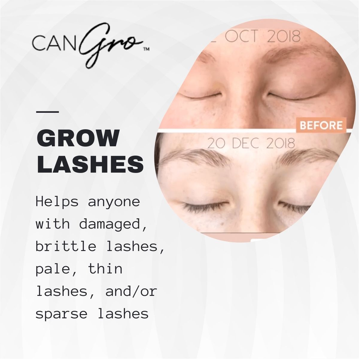 🇦🇺 Long Lashes Eyelash Enhancer  (Buy 1 Get 1 Free)