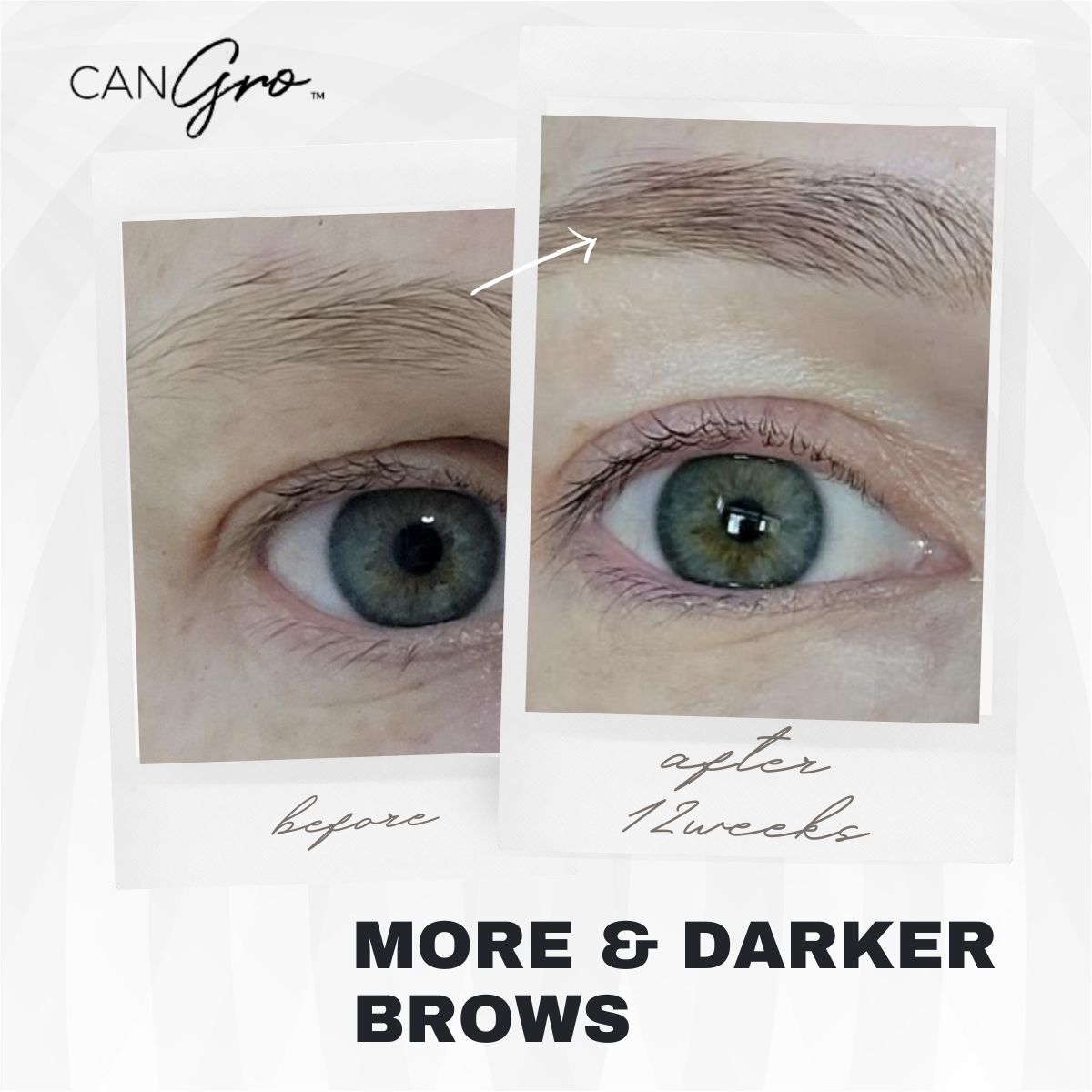 Bold Brows Eyebrow Enhancer (eyebrow growth serum)